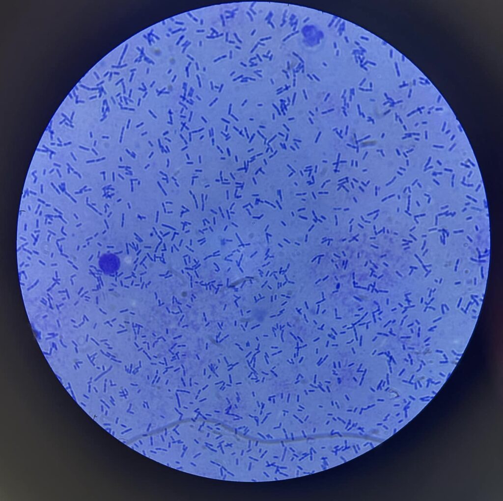 Ryc.1