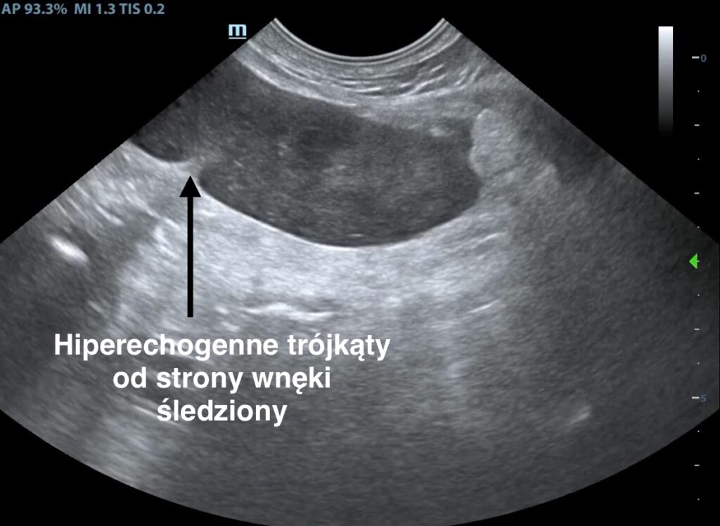 image_A647FC18-09A4-44D5-A3E7-902F56B550D9_1763843788