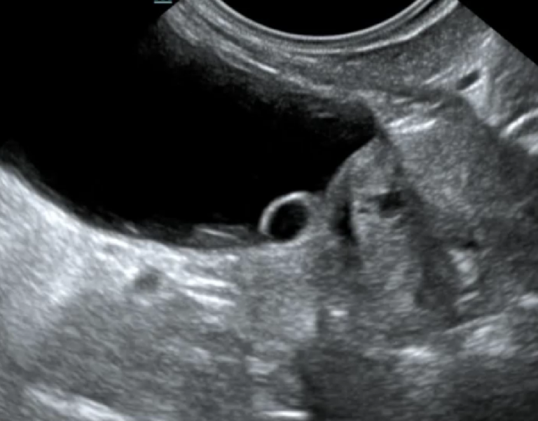 Diagnostyka ultrasonograficzna ureterocele u psów i kotów